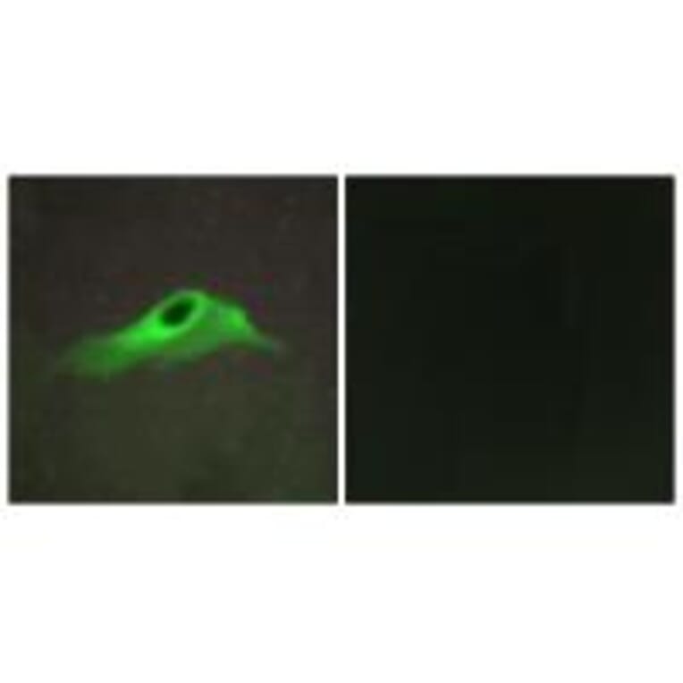 Immunofluorescence - Collagen IV α5 Antibody from Signalway Antibody (34204) - Antibodies.com