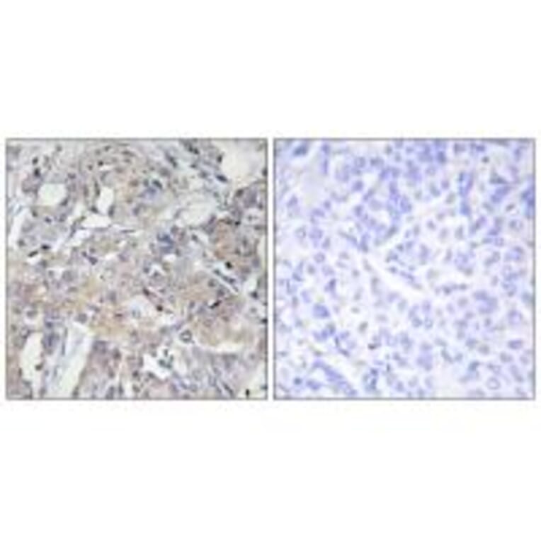 Immunohistochemistry - Collagen VI α3 Antibody from Signalway Antibody (34209) - Antibodies.com