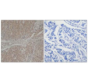 Immunohistochemistry - Smad3 (Ab-208) Antibody from Signalway Antibody (21324) - Antibodies.com