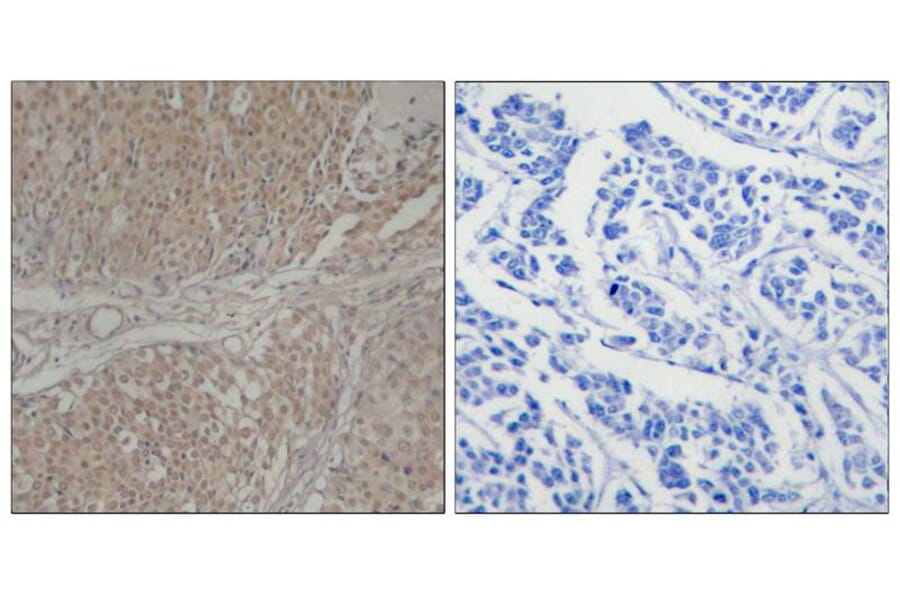 Immunohistochemistry - Smad3 (Ab-208) Antibody from Signalway Antibody (21324) - Antibodies.com