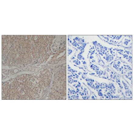 Immunohistochemistry - Smad3 (Ab-208) Antibody from Signalway Antibody (21324) - Antibodies.com