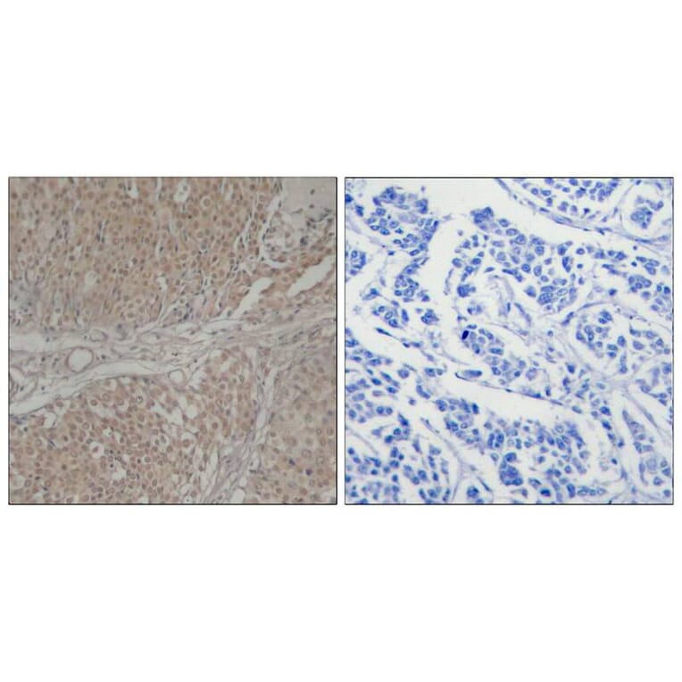 Immunohistochemistry - Smad3 (Ab-208) Antibody from Signalway Antibody (21324) - Antibodies.com