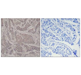 Immunohistochemistry - Smad3 (Ab-425) Antibody from Signalway Antibody (21325) - Antibodies.com