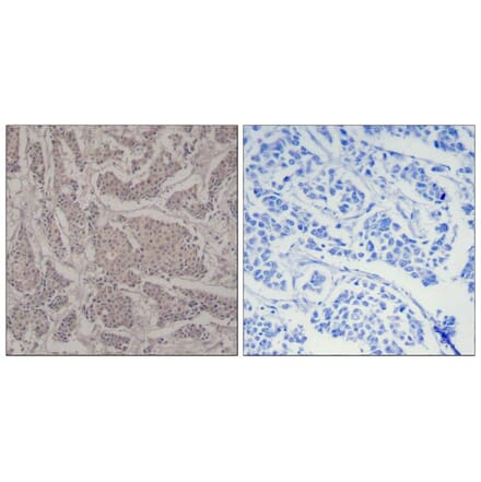 Immunohistochemistry - Smad3 (Ab-425) Antibody from Signalway Antibody (21325) - Antibodies.com