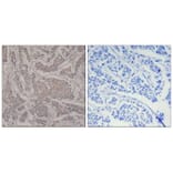 Immunohistochemistry - Smad3 (Ab-425) Antibody from Signalway Antibody (21325) - Antibodies.com
