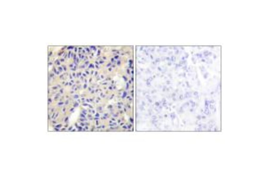 Immunohistochemistry - Collagen V α2 Antibody from Signalway Antibody (34206) - Antibodies.com