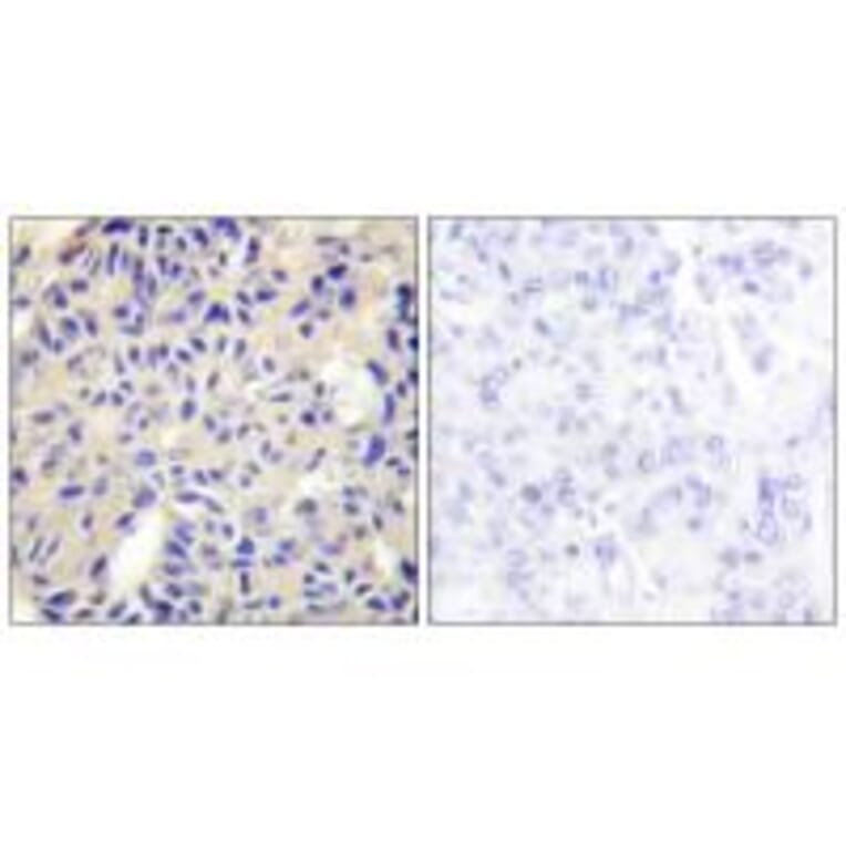 Immunohistochemistry - Collagen V α2 Antibody from Signalway Antibody (34206) - Antibodies.com