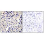 Immunohistochemistry - Collagen V α2 Antibody from Signalway Antibody (34206) - Antibodies.com