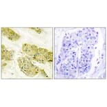 Immunohistochemistry - Collagen V α3 Antibody from Signalway Antibody (34207) - Antibodies.com