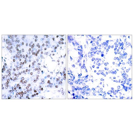 Immunohistochemistry - JunB (Ab-79) Antibody from Signalway Antibody (21026) - Antibodies.com