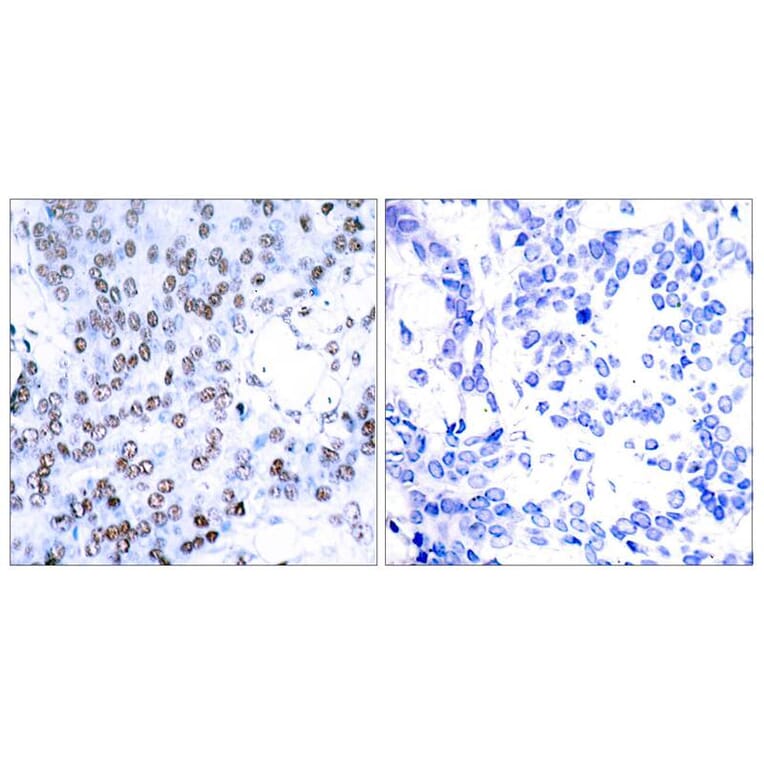 Immunohistochemistry - JunB (Ab-79) Antibody from Signalway Antibody (21026) - Antibodies.com