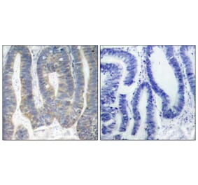 Immunohistochemistry - PKR (Ab-451) Antibody from Signalway Antibody (21282) - Antibodies.com
