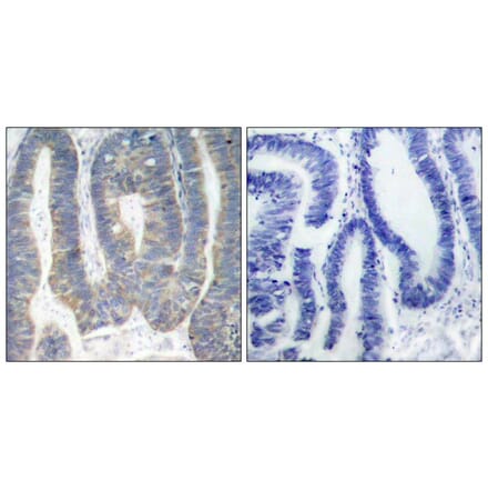 Immunohistochemistry - PKR (Ab-451) Antibody from Signalway Antibody (21282) - Antibodies.com