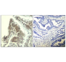 Immunohistochemistry - CDK6 (Ab-13) Antibody from Signalway Antibody (21542) - Antibodies.com