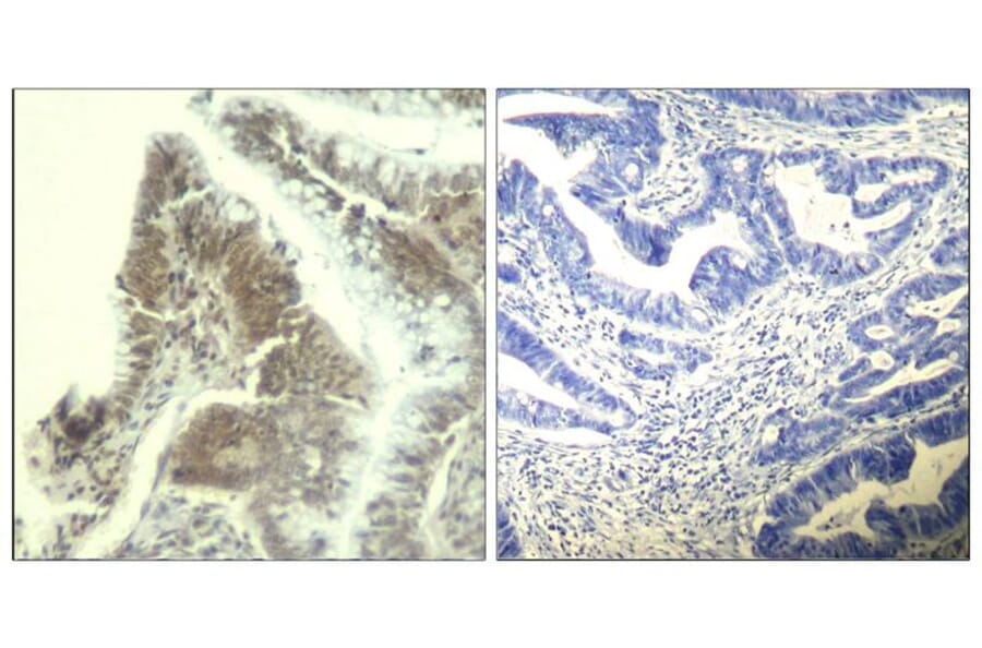 Immunohistochemistry - CDK6 (Ab-13) Antibody from Signalway Antibody (21542) - Antibodies.com