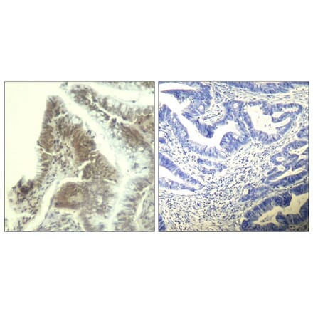 Immunohistochemistry - CDK6 (Ab-13) Antibody from Signalway Antibody (21542) - Antibodies.com