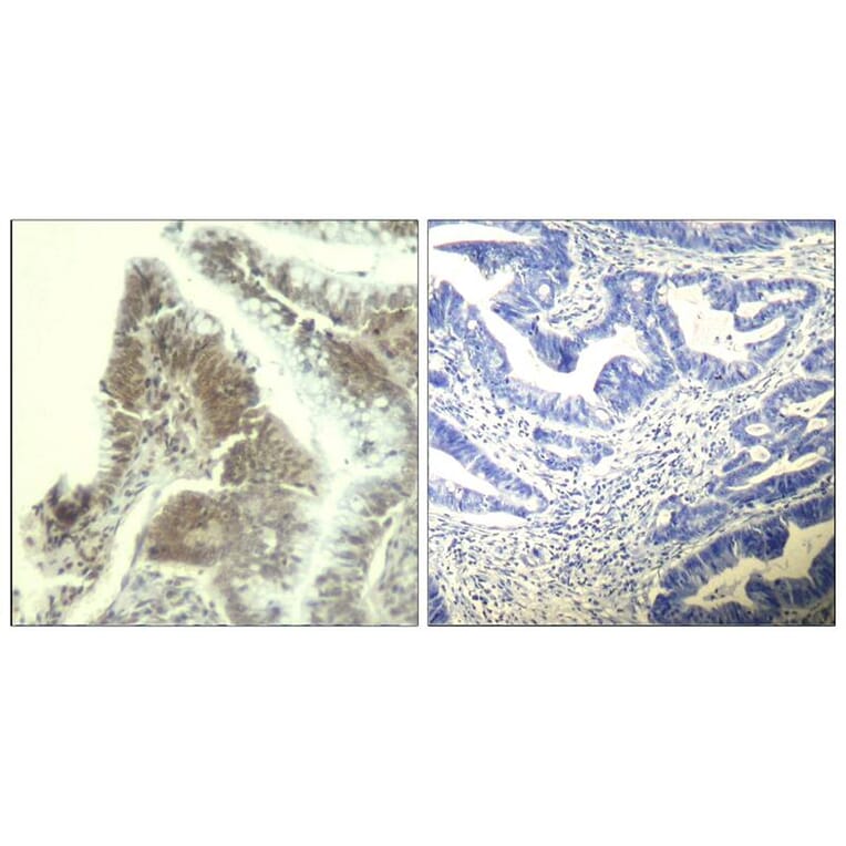 Immunohistochemistry - CDK6 (Ab-13) Antibody from Signalway Antibody (21542) - Antibodies.com