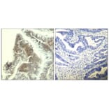 Immunohistochemistry - CDK6 (Ab-13) Antibody from Signalway Antibody (21542) - Antibodies.com
