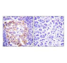 Immunohistochemistry - Collagen III Antibody from Signalway Antibody (33341) - Antibodies.com