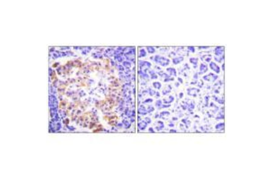 Immunohistochemistry - Collagen III Antibody from Signalway Antibody (33341) - Antibodies.com