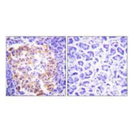 Immunohistochemistry - Collagen III Antibody from Signalway Antibody (33341) - Antibodies.com