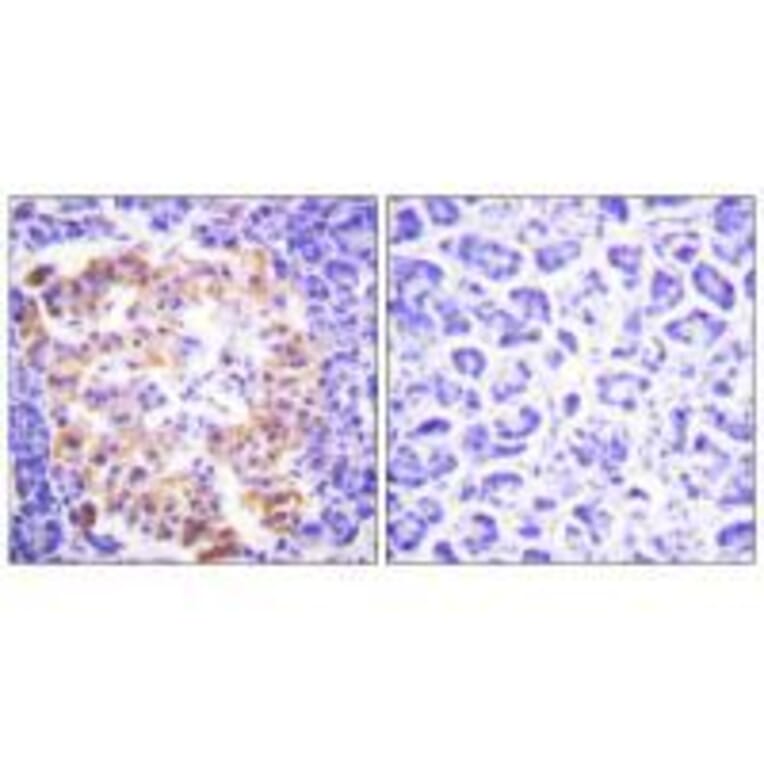 Immunohistochemistry - Collagen III Antibody from Signalway Antibody (33341) - Antibodies.com