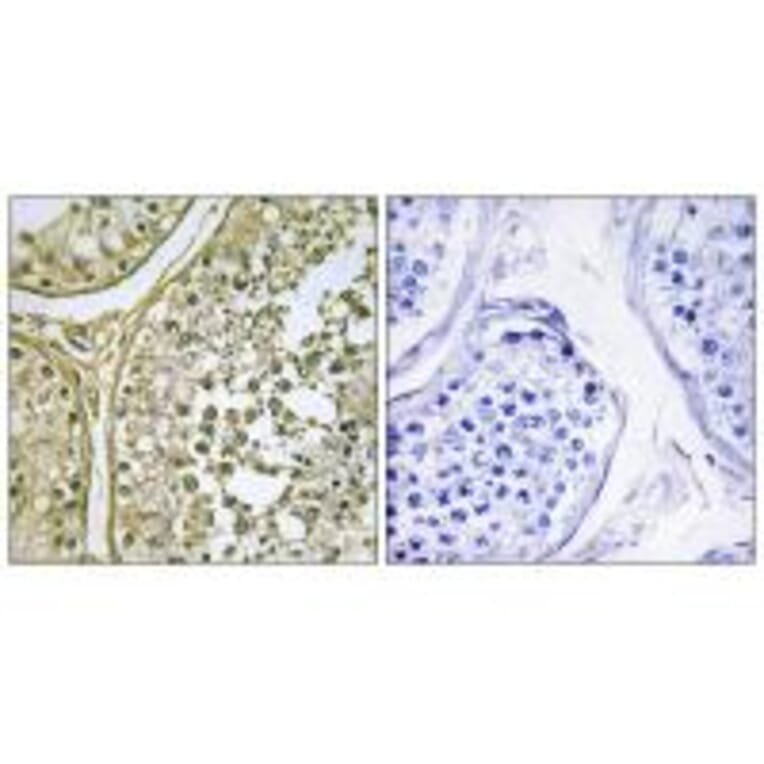 Immunohistochemistry - CKI-α1/L Antibody from Signalway Antibody (33969) - Antibodies.com
