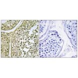 Immunohistochemistry - CKI-α1/L Antibody from Signalway Antibody (33969) - Antibodies.com