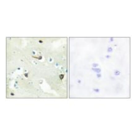 Immunohistochemistry - EPHB1/2/3 Antibody from Signalway Antibody (34676) - Antibodies.com
