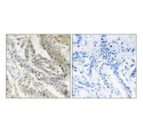 Immunohistochemistry - CRBP III Antibody from Signalway Antibody (33839) - Antibodies.com