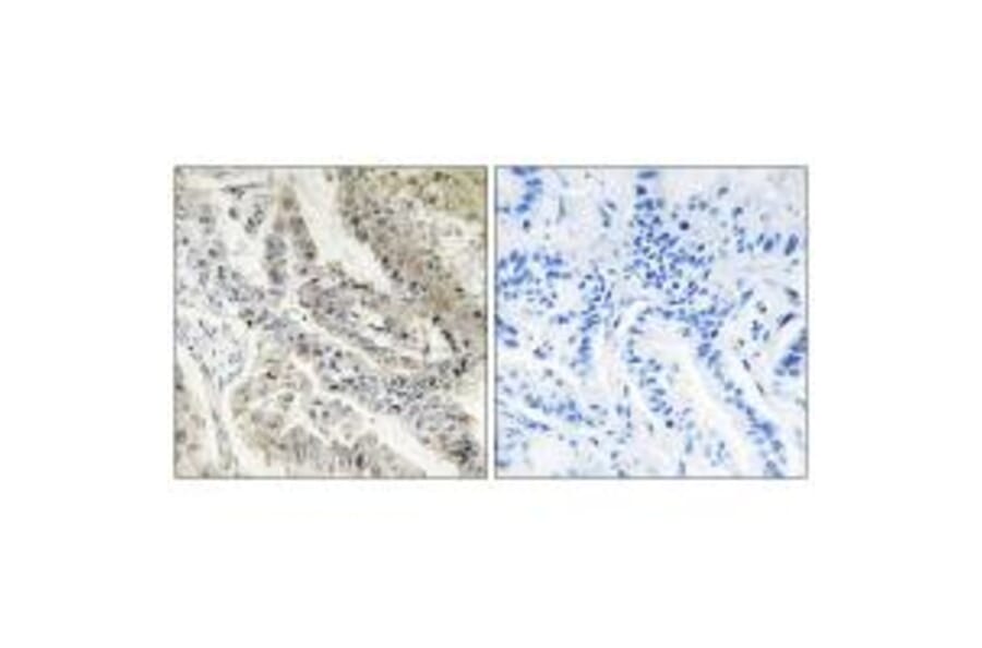 Immunohistochemistry - CRBP III Antibody from Signalway Antibody (33839) - Antibodies.com