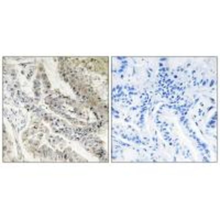 Immunohistochemistry - CRBP III Antibody from Signalway Antibody (33839) - Antibodies.com