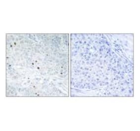 Immunohistochemistry - TP53INP2 Antibody from Signalway Antibody (33963) - Antibodies.com
