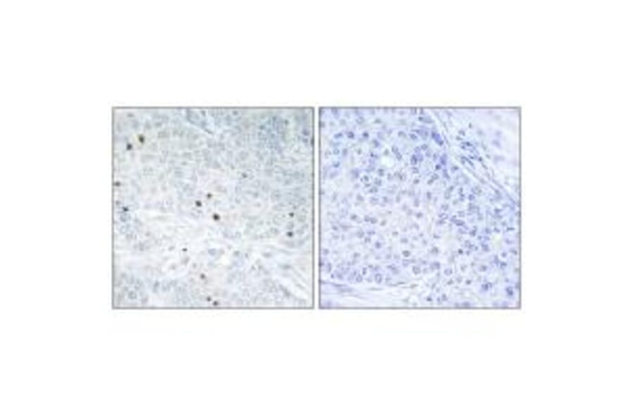 Immunohistochemistry - TP53INP2 Antibody from Signalway Antibody (33963) - Antibodies.com