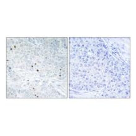 Immunohistochemistry - TP53INP2 Antibody from Signalway Antibody (33963) - Antibodies.com