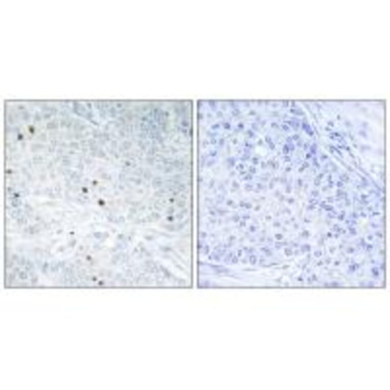 Immunohistochemistry - TP53INP2 Antibody from Signalway Antibody (33963) - Antibodies.com