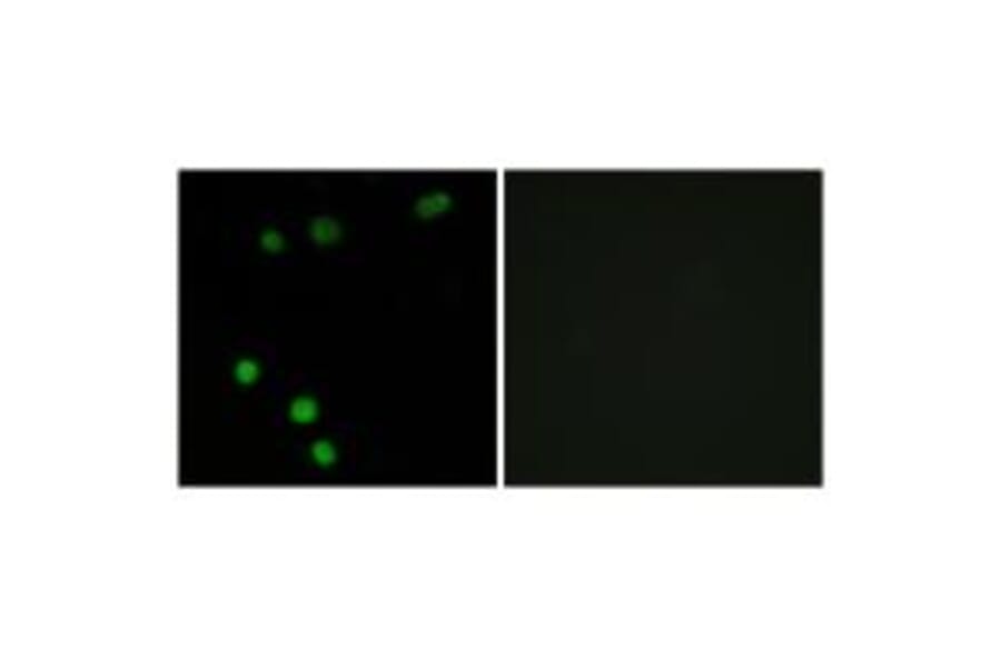 Immunofluorescence - TP53INP2 Antibody from Signalway Antibody (33963) - Antibodies.com