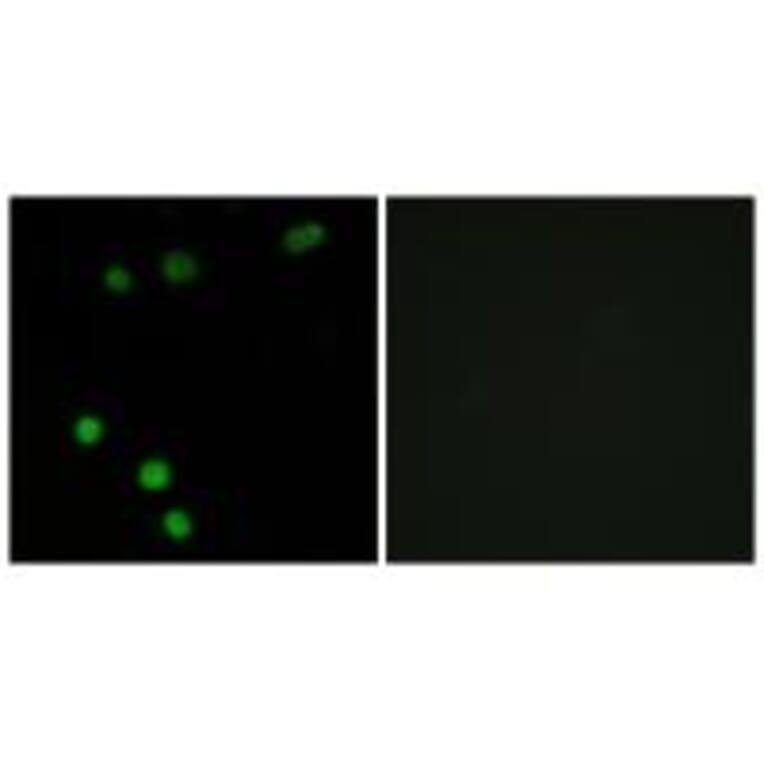 Immunofluorescence - TP53INP2 Antibody from Signalway Antibody (33963) - Antibodies.com