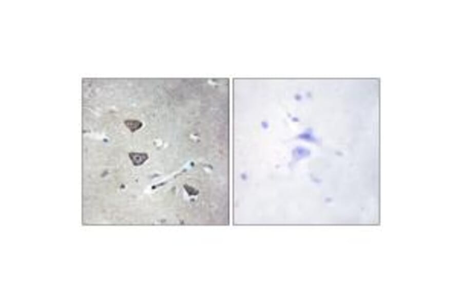 Immunohistochemistry - 5-HT-2C Antibody from Signalway Antibody (34151) - Antibodies.com