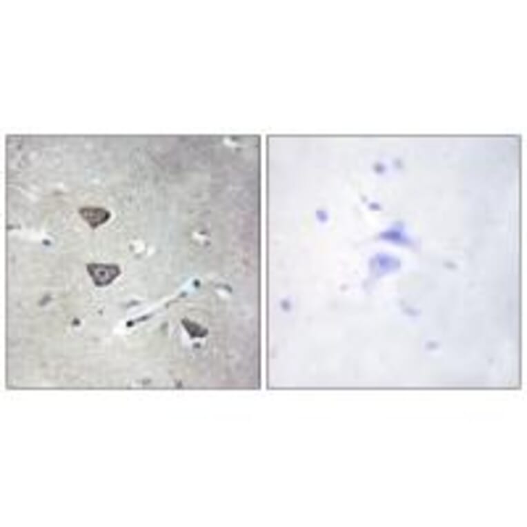 Immunohistochemistry - 5-HT-2C Antibody from Signalway Antibody (34151) - Antibodies.com