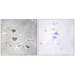 Immunohistochemistry - 5-HT-2C Antibody from Signalway Antibody (34151) - Antibodies.com