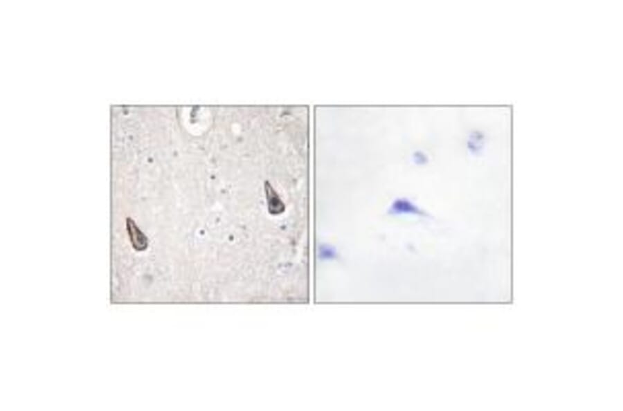 Immunohistochemistry - ADCY5/6 Antibody from Signalway Antibody (34162) - Antibodies.com