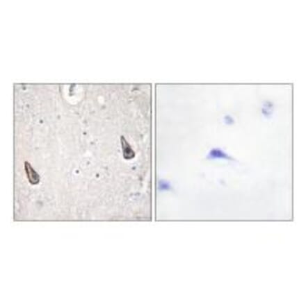 Immunohistochemistry - ADCY5/6 Antibody from Signalway Antibody (34162) - Antibodies.com
