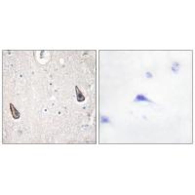 Immunohistochemistry - ADCY5/6 Antibody from Signalway Antibody (34162) - Antibodies.com