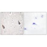 Immunohistochemistry - ADCY5/6 Antibody from Signalway Antibody (34162) - Antibodies.com