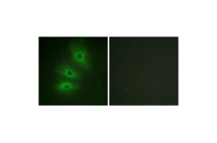 Immunofluorescence - ADCY5/6 Antibody from Signalway Antibody (34162) - Antibodies.com