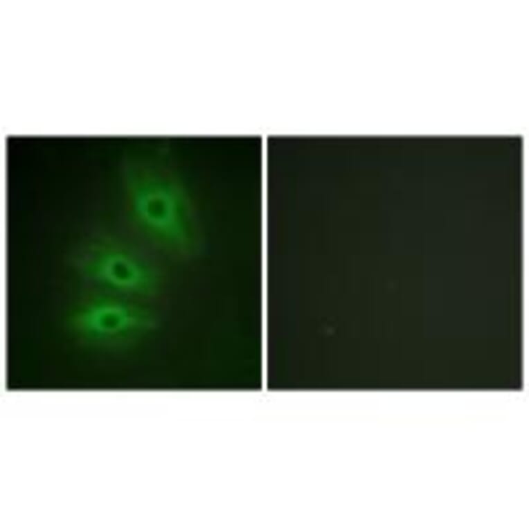 Immunofluorescence - ADCY5/6 Antibody from Signalway Antibody (34162) - Antibodies.com