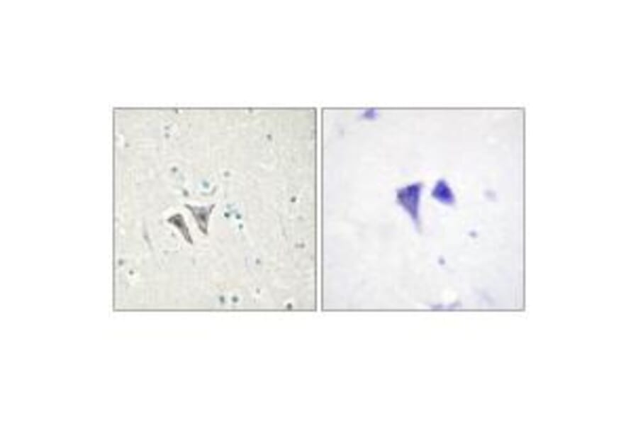 Immunohistochemistry - ACTR-1C Antibody from Signalway Antibody (33973) - Antibodies.com
