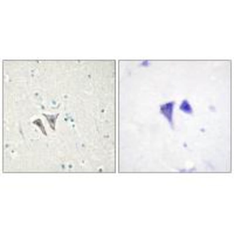 Immunohistochemistry - ACTR-1C Antibody from Signalway Antibody (33973) - Antibodies.com