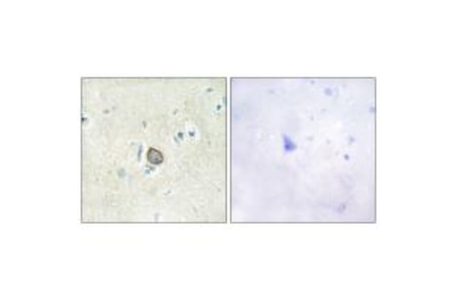 Immunohistochemistry - CELSR3 Antibody from Signalway Antibody (34198) - Antibodies.com
